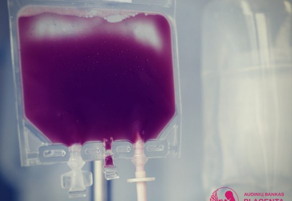 Placentos kraujo išsaugojimas: nauja galimybė!